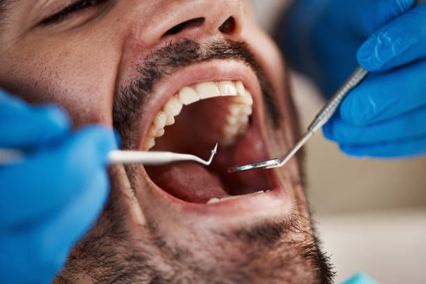 Best Urgent Tooth Repair  in Vine Grove, KY